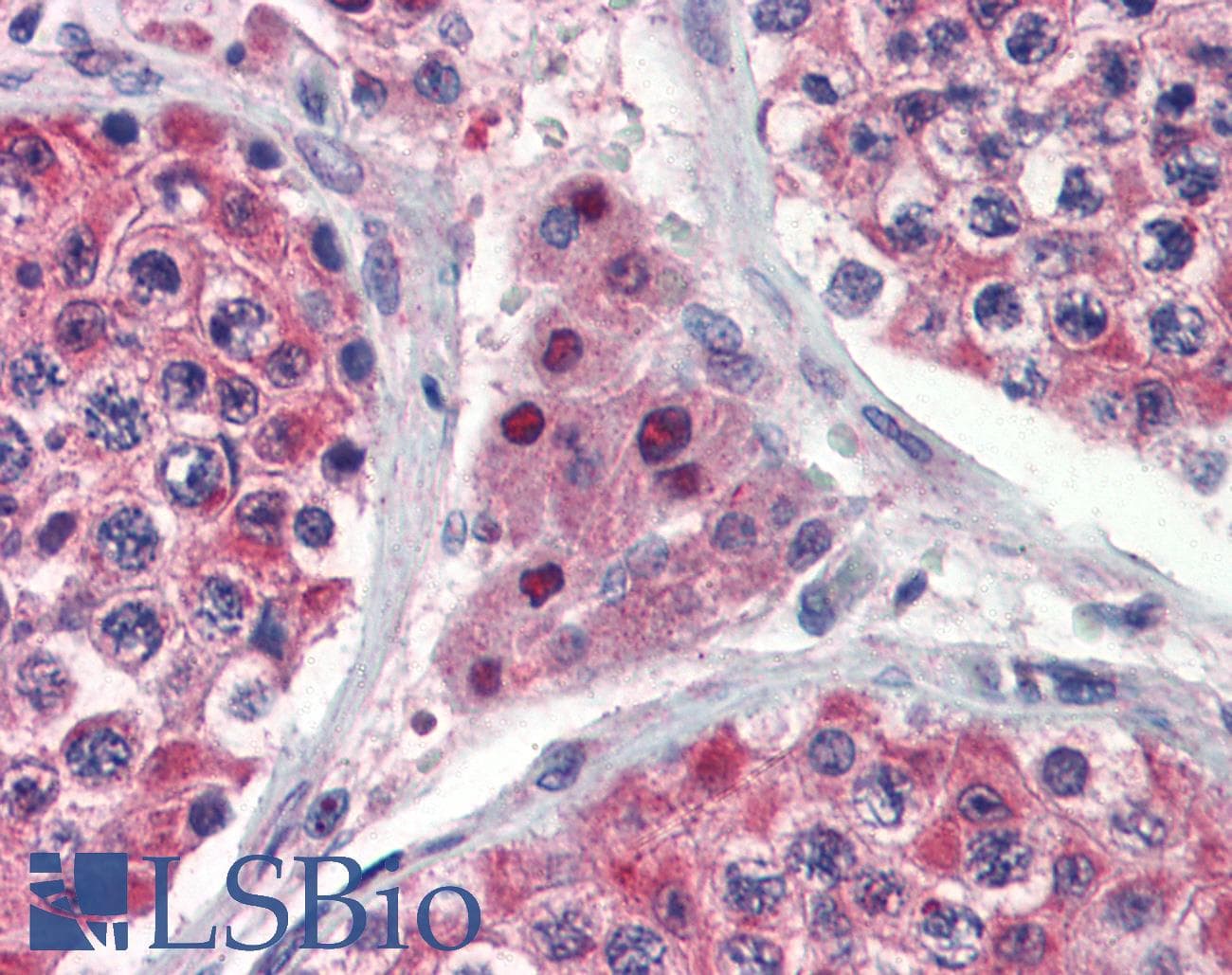 PathPlus™ IDH1 / IDH Antibody (aa290-339)