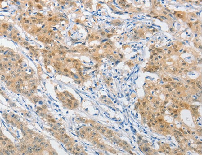 HSP40 Antibody