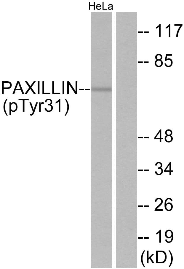 Polyclonal Rabbit anti-Human PXN / Paxillin Antibody (phospho-Tyr31, WB)