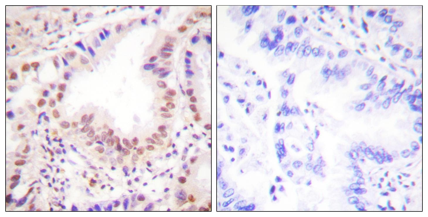 ETS1 / ETS-1 Antibody (aa11-60)