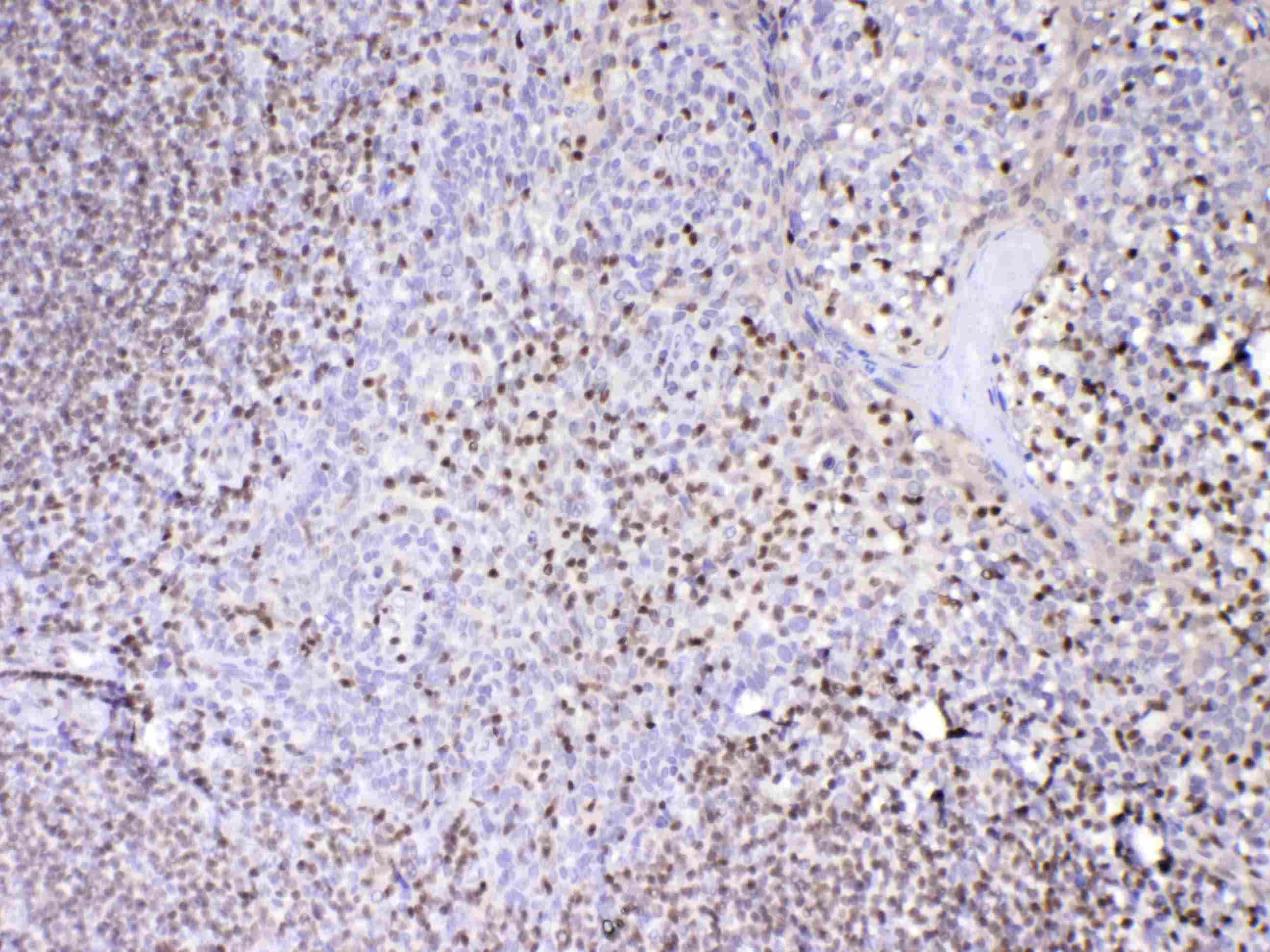 Polyclonal Rabbit anti-Human PAX5 Antibody (IHC, WB)