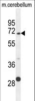 GPC5 / Glypican 5 Antibody (aa56-84)