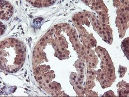 FGF21 Antibody (clone OTI2F10)