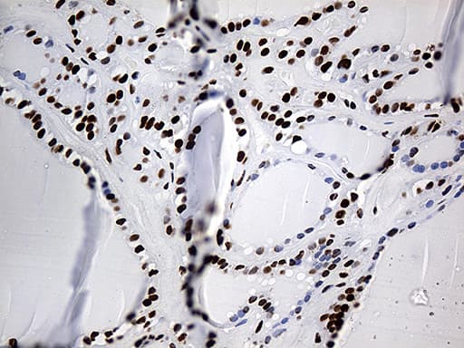 HNRNPH1 / hnRNP H Antibody (clone OTI5D11)