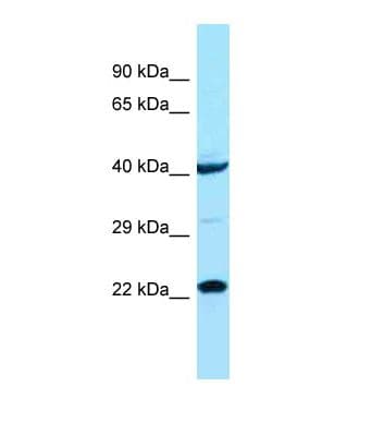 Polyclonal Rabbit anti-Human ASCL1 / MASH1 Antibody (aa50-99, WB)