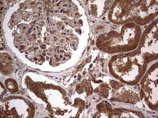 Monoclonal Mouse anti-Human ARAF / ARAF1 / A-RAF Antibody (clone OTI2G9, aa145-365, IHC, WB)