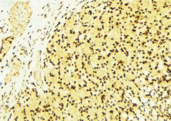 PRMT1 Antibody