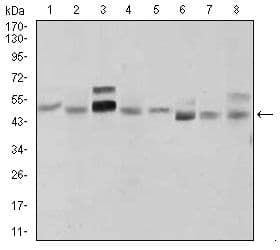 Monoclonal Mouse anti-Human SHH / Sonic Hedgehog Antibody (clone 5H4, Amino Acid: 26-161, IHC, WB)
