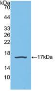 SNRPD1 / SMD1 Antibody (aa1-119)