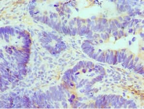 ATRIP Antibody (aa1-260)