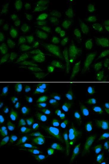 DCN / Decorin Antibody