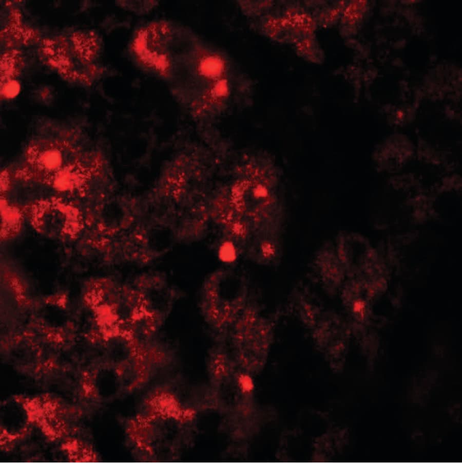 TMEM106B Antibody