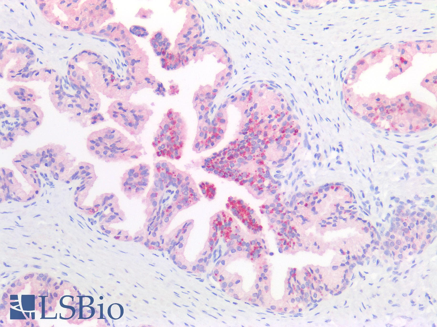 IHC-plus™ KLK2 / Kallikrein 2 Antibody (clone 6B7)