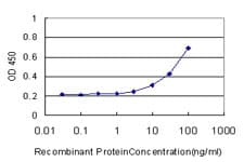 Monoclonal Mouse anti-Human CA8 / Carbonic Anhydrase VIII Antibody (clone 1F7, WB)