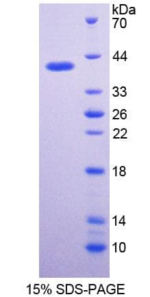 Rabbit IFNA / Interferon Alpha Protein (Recombinant His-GST)