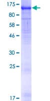 Human WDR24 Protein (Recombinant GST)