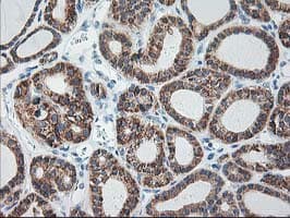 RPN1 / Ribophorin I Antibody (clone OTI3H3)
