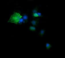 Monoclonal Mouse anti-Human DPCD Antibody (clone OTI8A12, IHC, IF, WB)