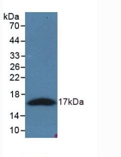 NT-proANP Antibody