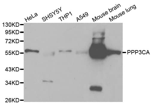 Polyclonal Rabbit anti-Human PPP3CA / CCN1 / Calcineurin A Antibody (IHC, IF, WB)