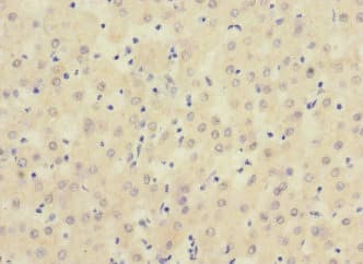 Polyclonal Rabbit anti-Human SIGIRR Antibody (IHC, WB)
