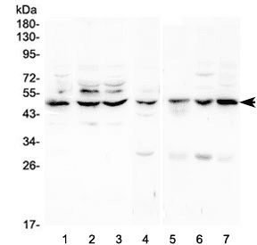 TNFRSF1A / TNFR1 Antibody