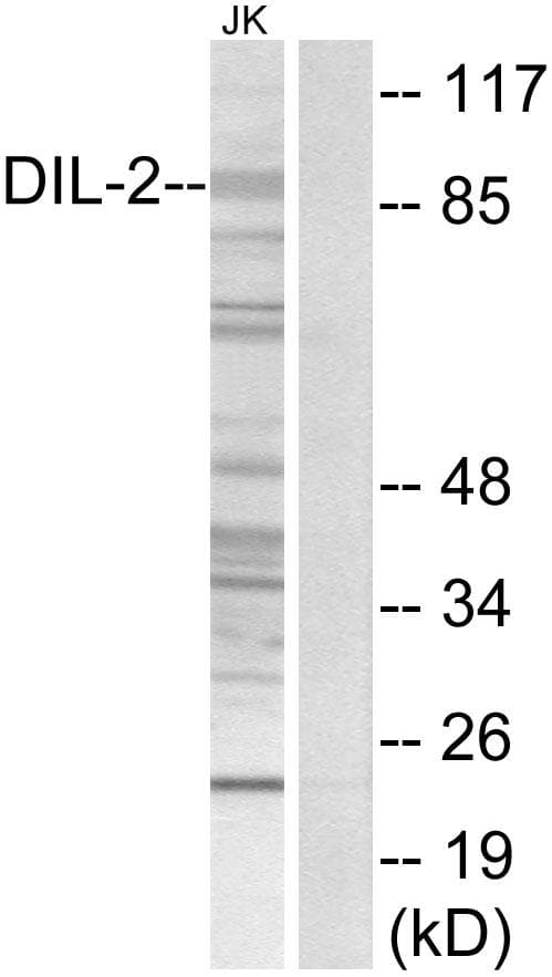 TPX2 Antibody