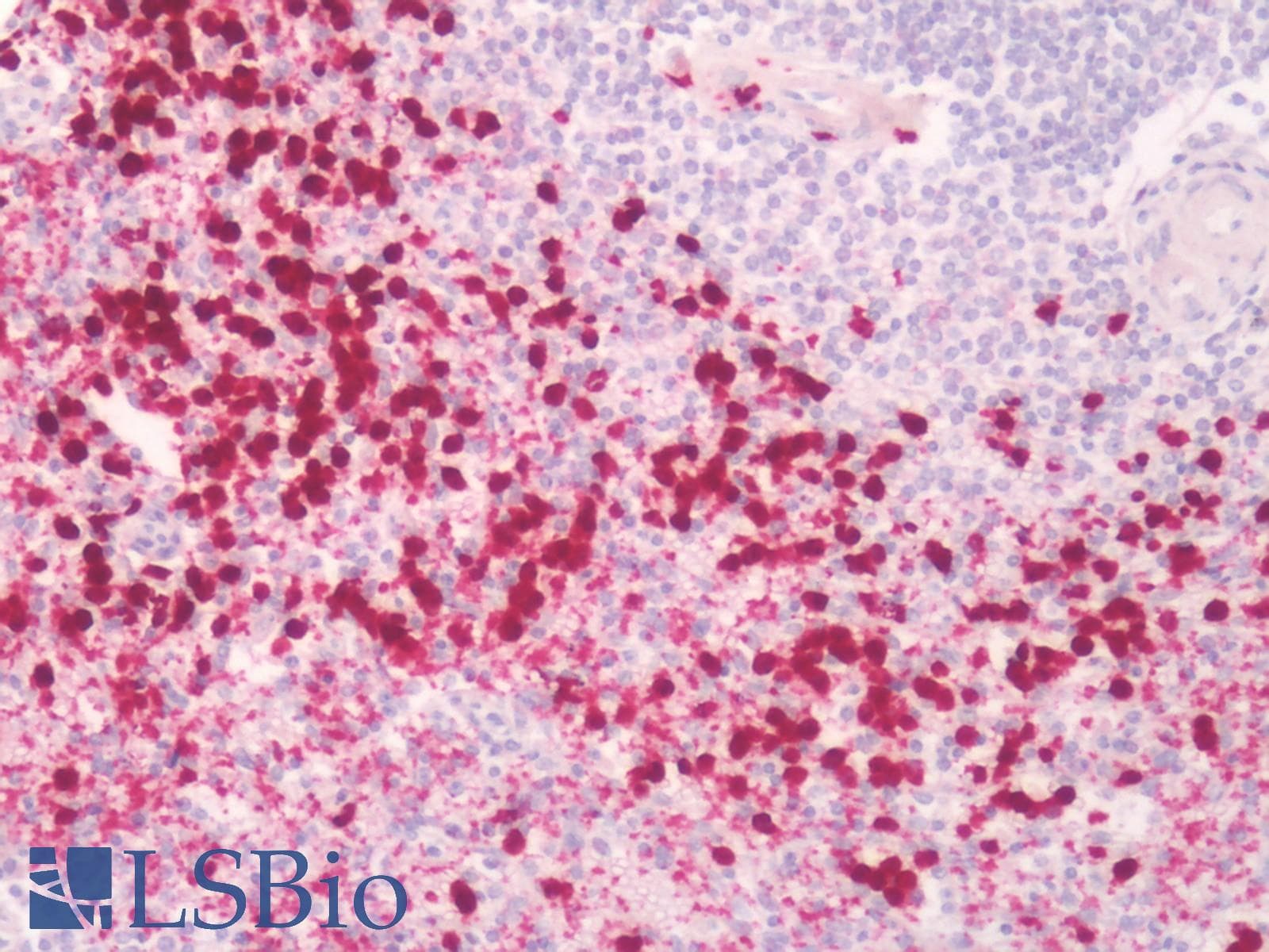 PathPlus™ Polyclonal Rabbit anti-Human PGES / PTGES Antibody (Cytoplasmic Domain, IHC)
