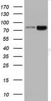 DGKB / DGK Beta Antibody (clone OTI1F9)