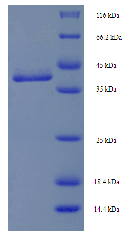 Human MIS12 Protein (Recombinant His-SUMO)