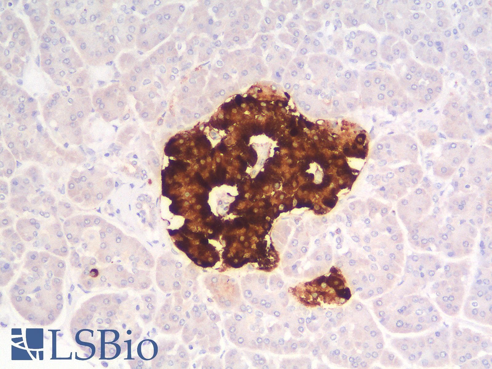 PathPlus™ CHGA / Chromogranin A Antibody (clone CHGA/1773R)