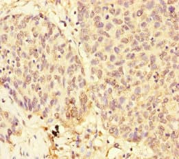 USP28 Antibody