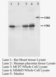 KCNN4 / KCa3.1 Antibody (aa11-28)