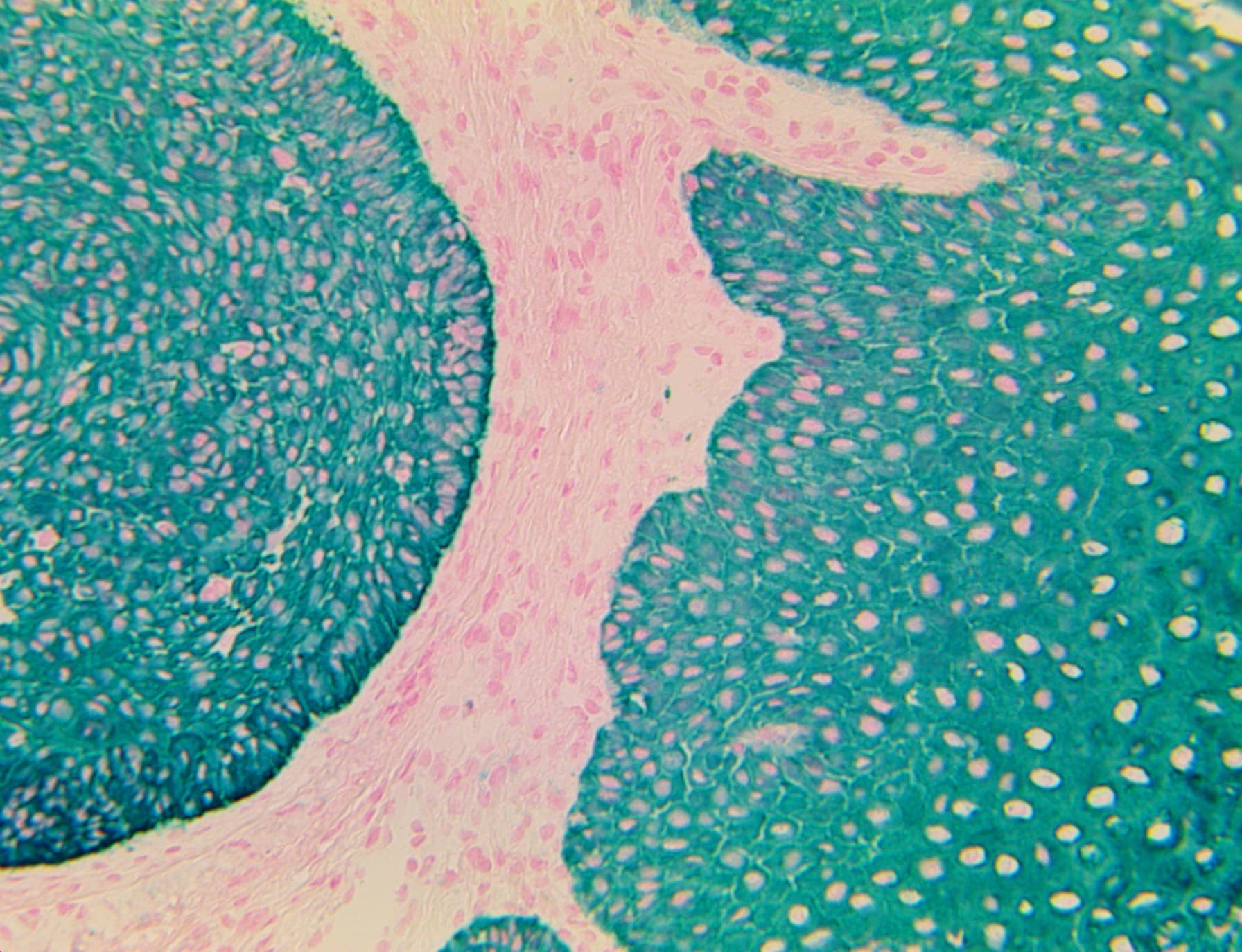 Monoclonal Mouse anti-Human Cytokeratin AE1+AE3 Antibody (clone AE1/AE3, Ready-to-Use, IHC)