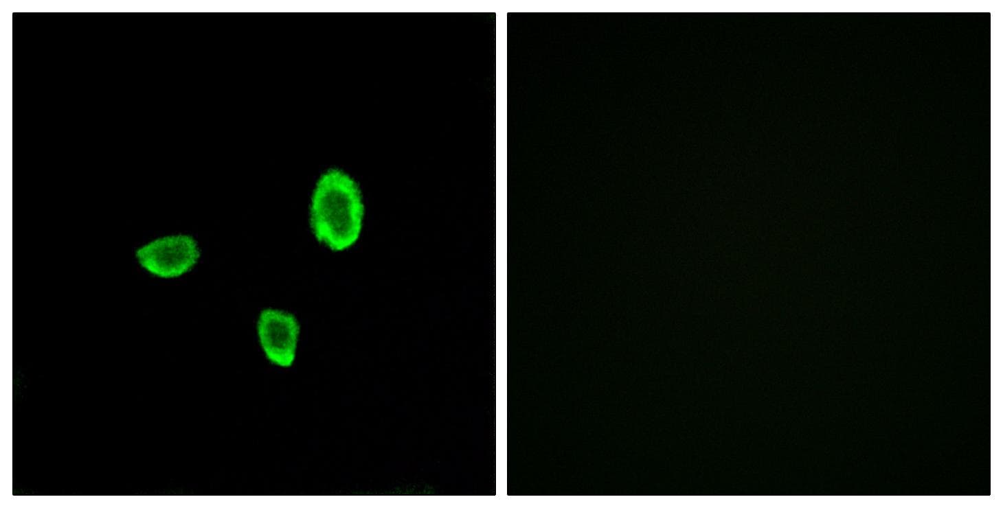 OR10G7 Antibody