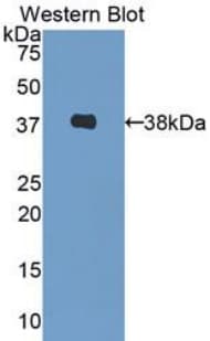 DCN / Decorin Antibody (aa31-359, PE)