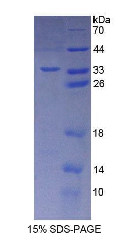 Mouse BCL10 / BCL-10 Protein (Recombinant His-T7)
