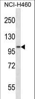 ADAM8 Antibody (aa126-155)
