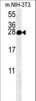 Polyclonal Rabbit anti-Human C5orf15 Antibody (aa123-150, WB)