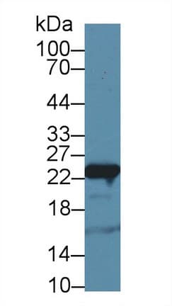 GSTP1 / GST Pi Antibody (aa1-210, PE)