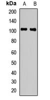 PLG / Plasmin / Plasminogen Antibody