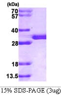 Human SPR Protein (Recombinant His)