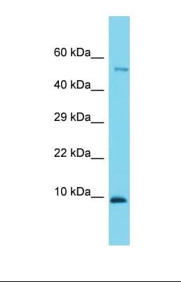 CCDC167 / C6orf129 Antibody (N-Terminus)