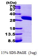 Human AUH Protein (Recombinant His)