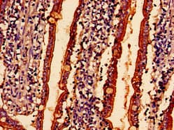 ABHD10 Antibody