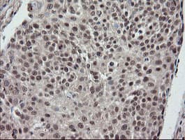 ESRRG / ERR Gamma Antibody (aa24-263, clone OTI1E5)