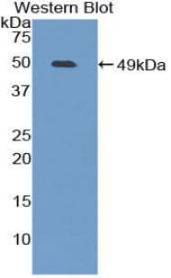 FURIN Antibody (aa578-734)