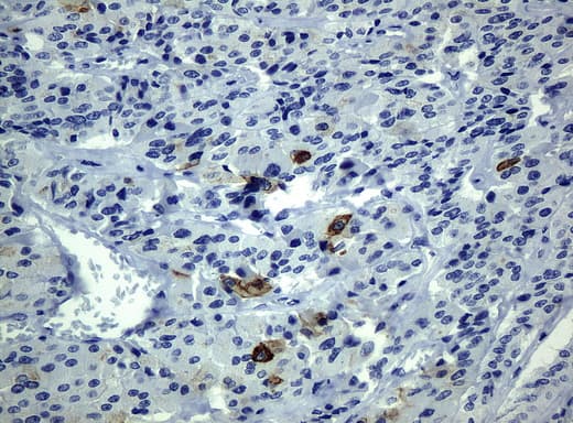 Monoclonal Mouse anti-Human KRT19 / CK19 / Cytokeratin 19 Antibody (clone UMAB3, aa240-390, IHC, IF, WB)