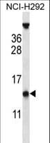 PYDC1 Antibody (aa13-42)
