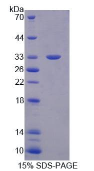 Human TBCB / CKAP1 Protein (Recombinant His, N-Terminal)